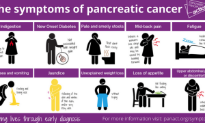 pancreatic cancer jason yun circadian rhythm coach